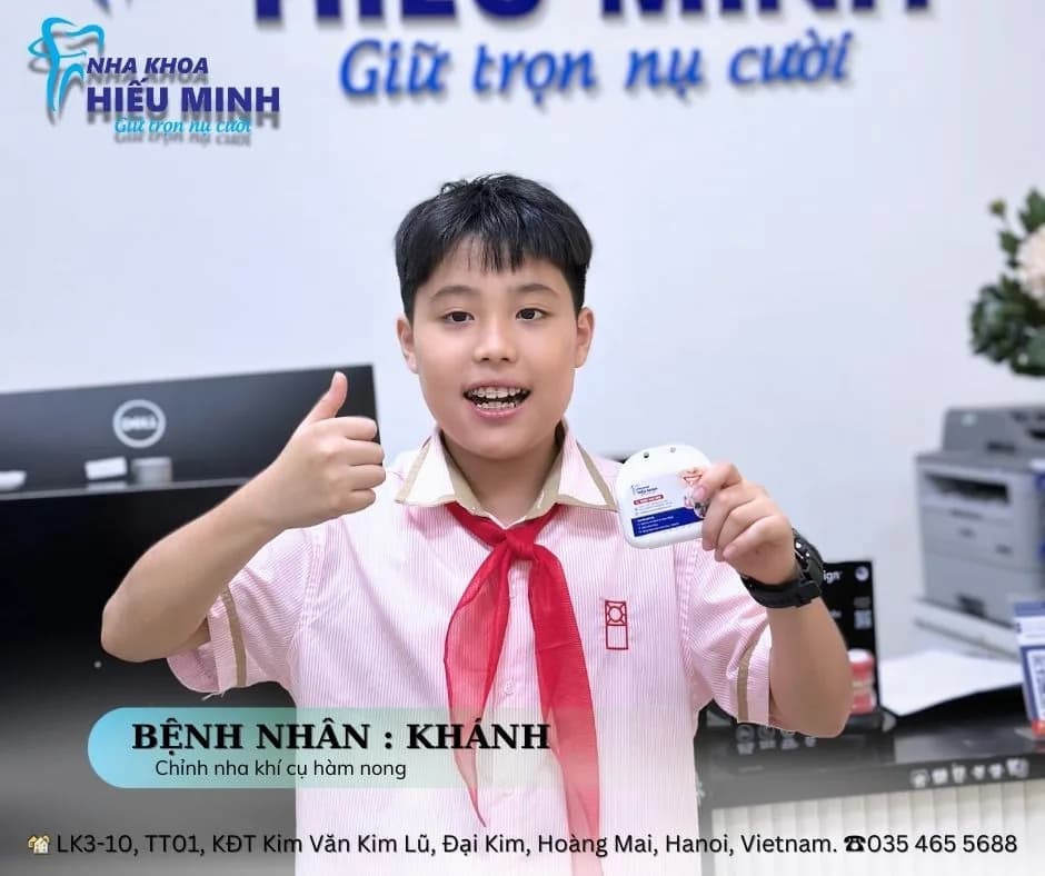Hàm duy trì sau niềng: vì sao bắt buộc phải đeo và đeo đến bao giờ