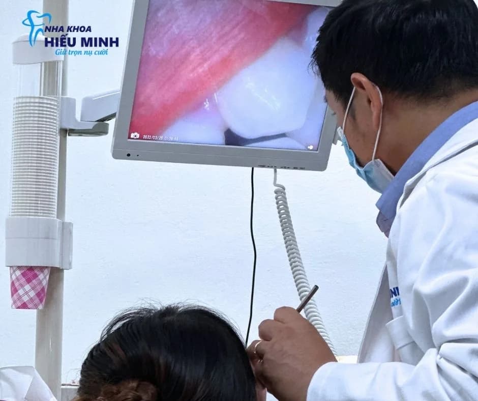 Camera nội soi trong miệng hiển thị tình trạng răng trực tiếp lên màn hình