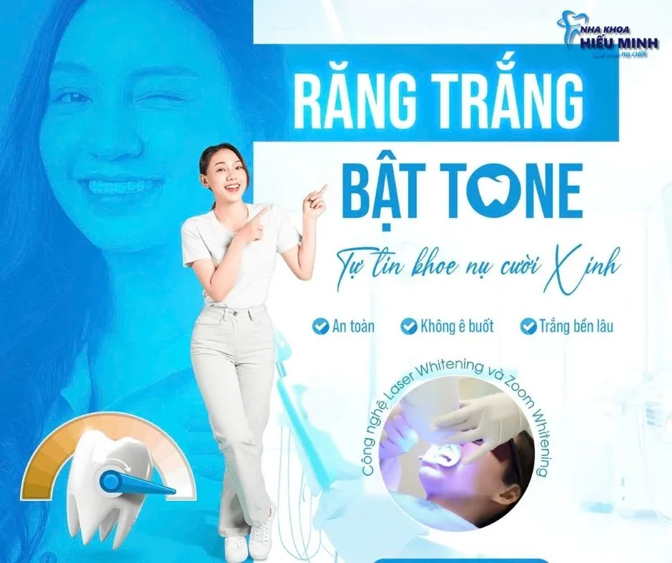 Tẩy trắng răng bật tone bằng công nghệ Laser Whitening