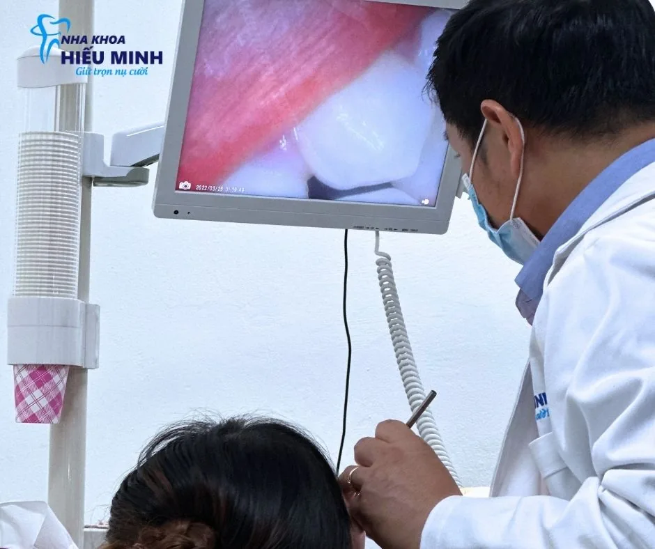 Camera nội soi trong miệng hiển thị tình trạng răng trực tiếp lên màn hình