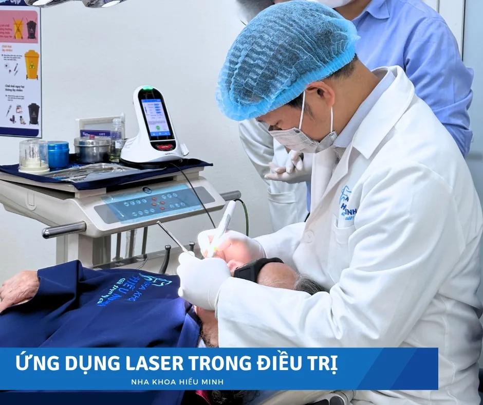 Ứng dụng Laser trong điều trị nha khoa tại Nha khoa Hiếu Minh