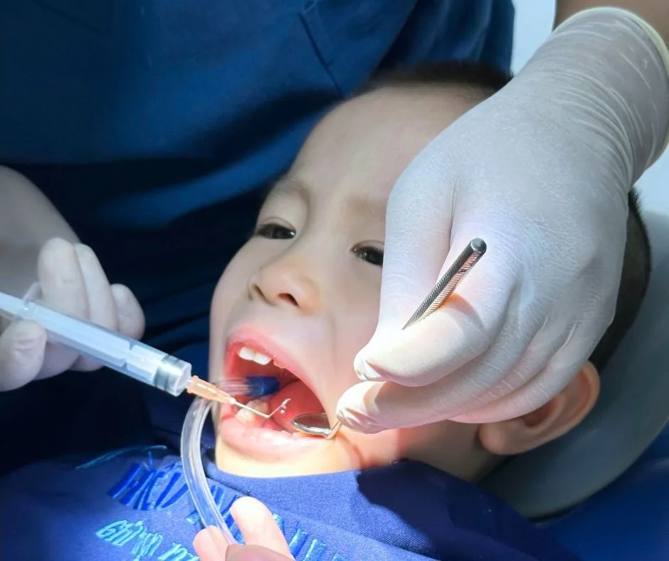 Bác sĩ gây tê nhẹ nhàng cho bé trước khi điều trị răng