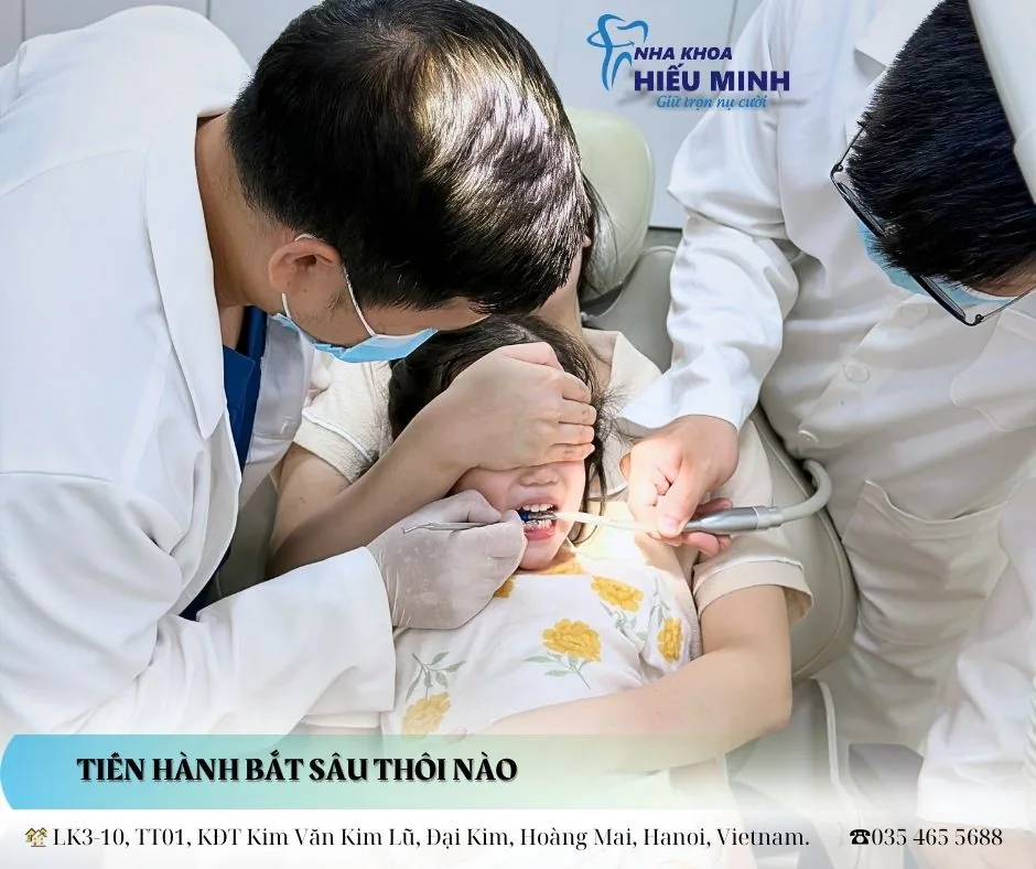 Phát hiện và xử lý sâu răng sớm cho trẻ em